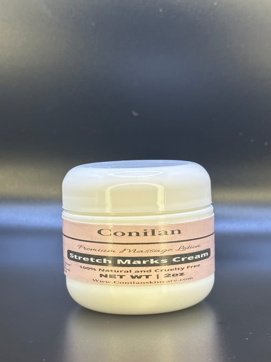 Stretch Mark Cream